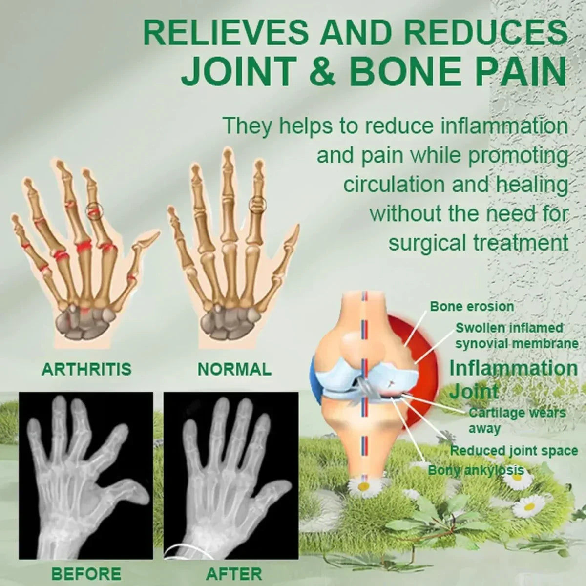 VenomFlex Pain Relief Cream — Natural. Powerful. Fast. 💪🌿🐝 ( BUY 1 GET 1 FREE)