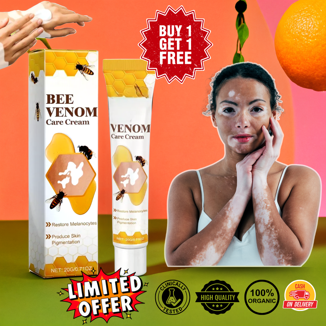 Bee Venom VitiGO Correcting Cream - Buy 1 Get 1 FREEš„š„