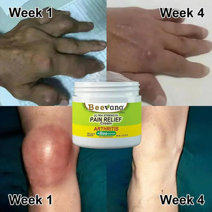 VenomFlex Pain Relief Cream — Natural. Powerful. Fast. 💪🌿🐝 ( BUY 1 GET 1 FREE)